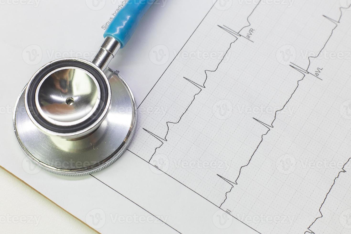 estetoscopios azules y gráfico de electrocardiografía imagen de primer plano. foto