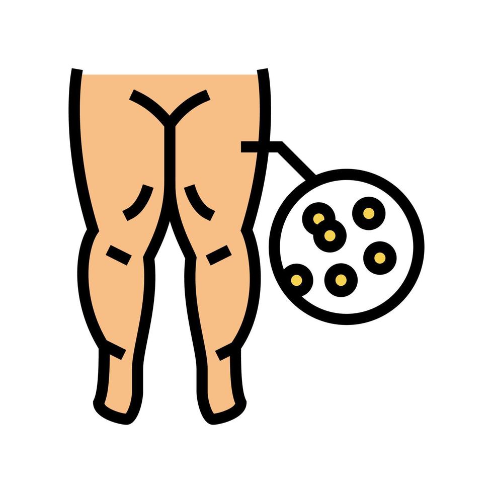 hypoproteinemic edema color icon vector illustration