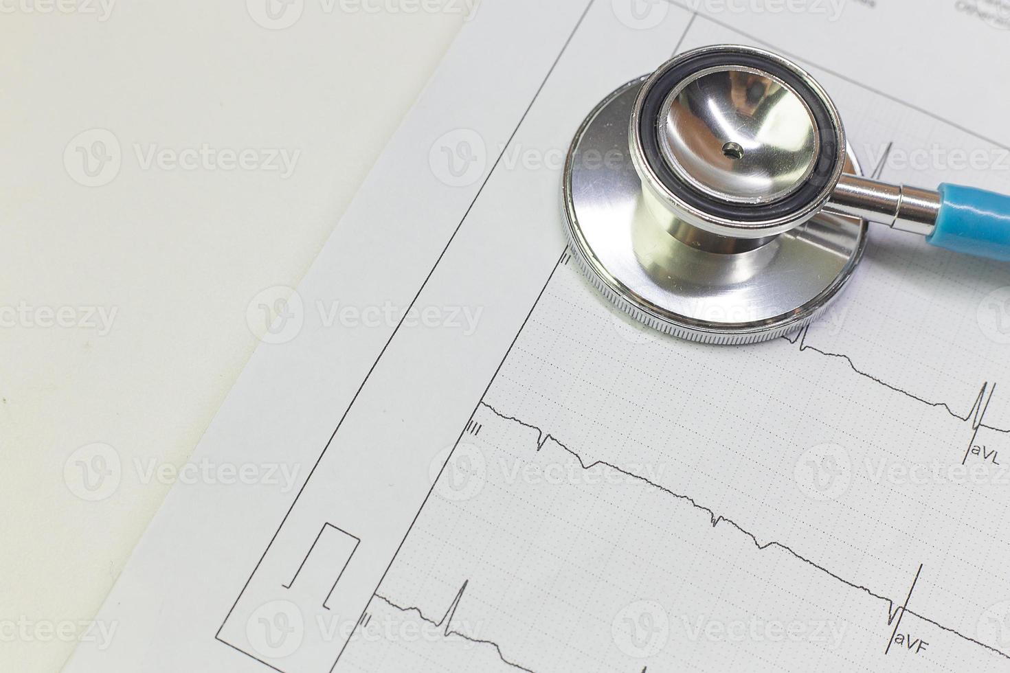 Blue stethoscopes and  Electrocardiography  chart close up image. photo