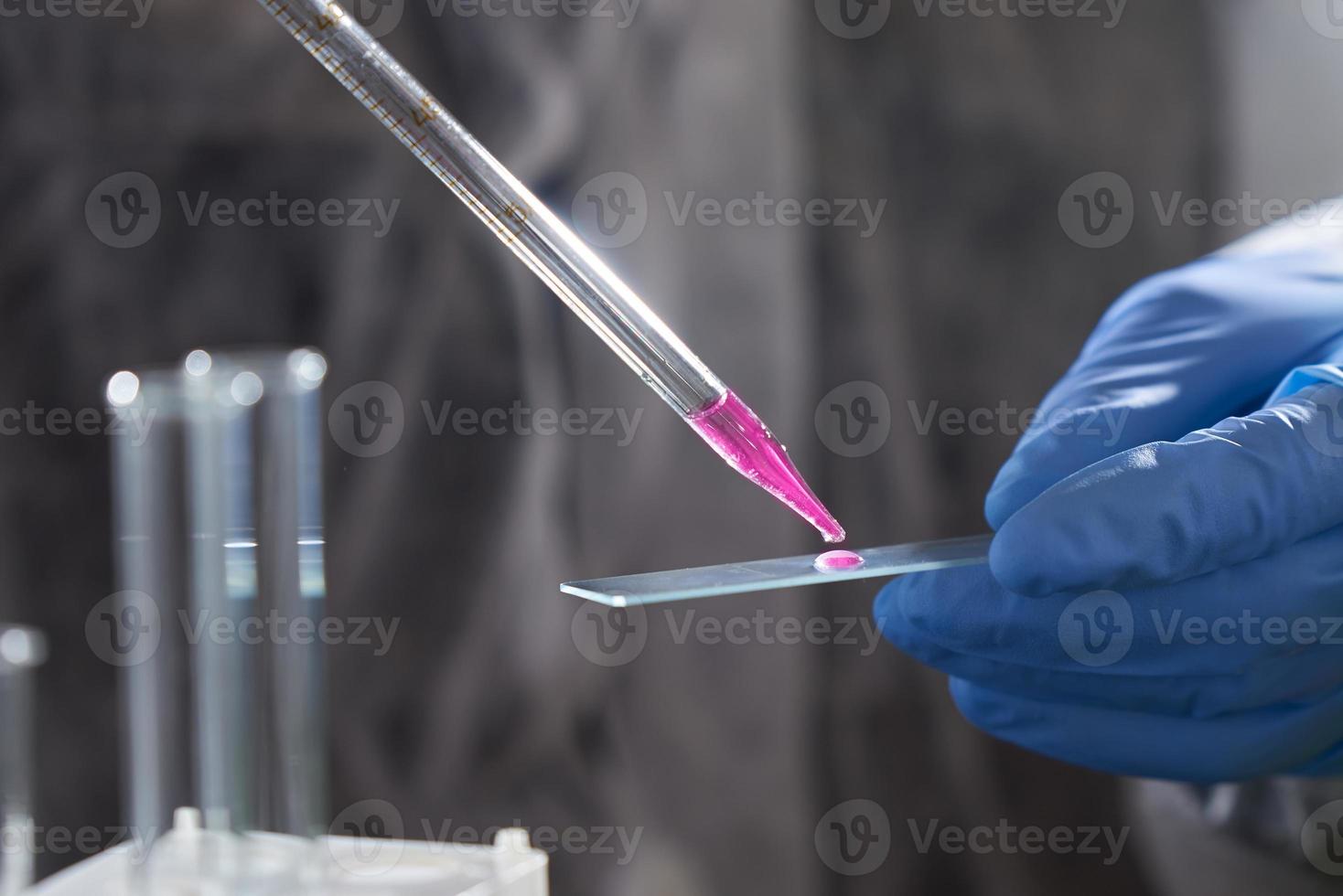 The scientist is working on creating vaccine in laboratory. The concept of creating a vaccine. photo