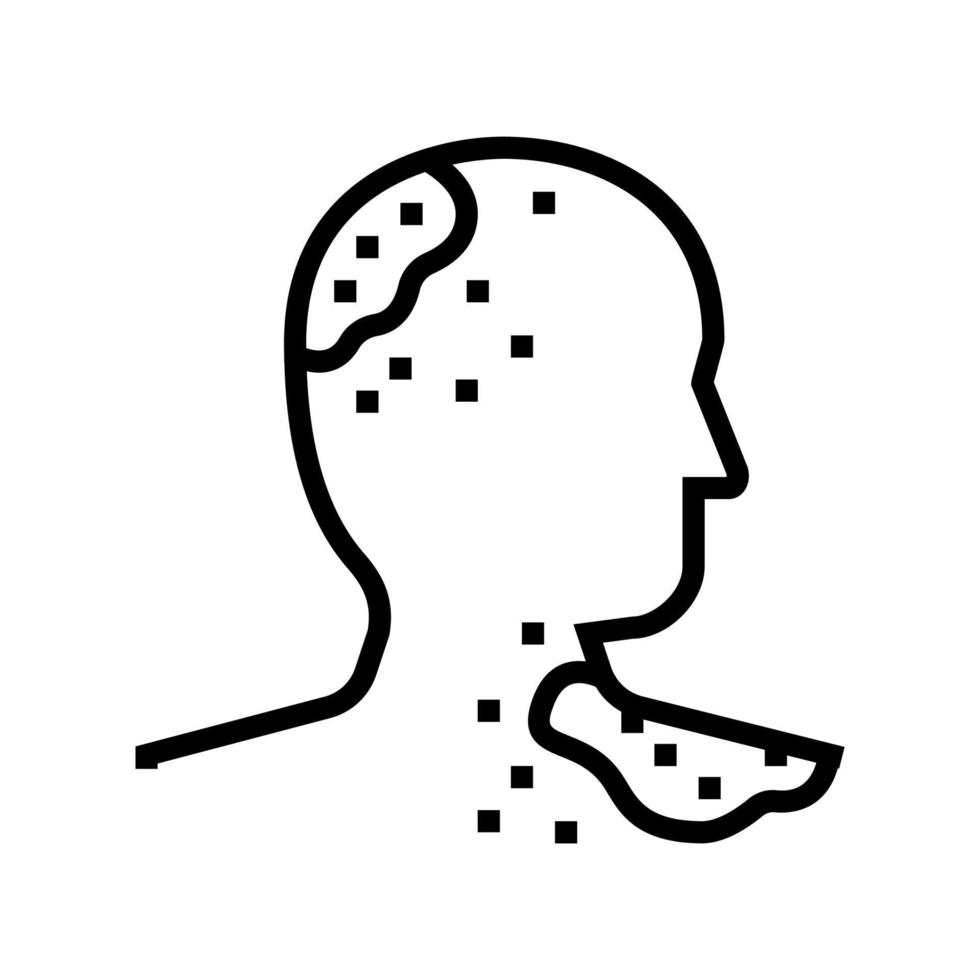 ilustración de vector de icono de línea de piel de alergia