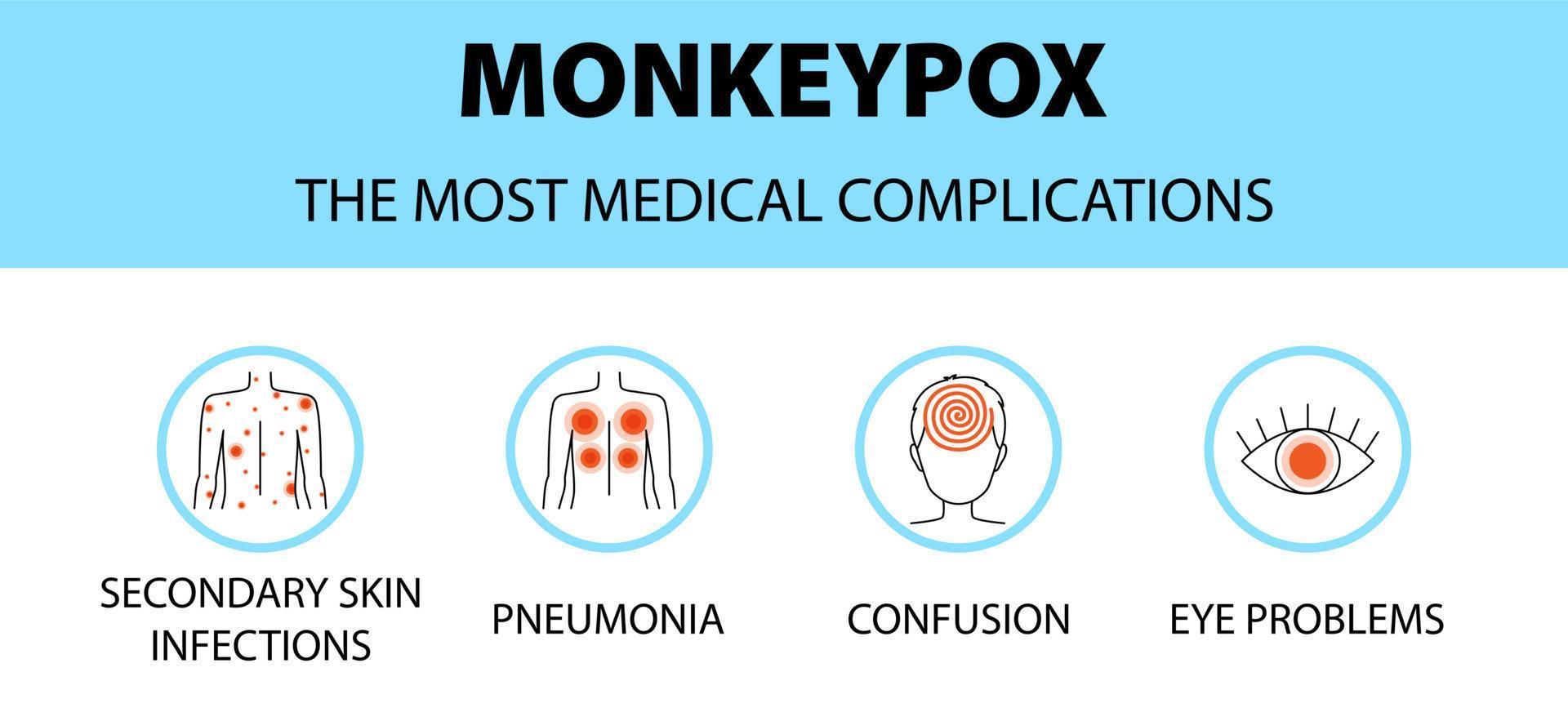 Monkeypox virus icons infographic. The most medical complications. New outbreak cases in Europe and USA. vector