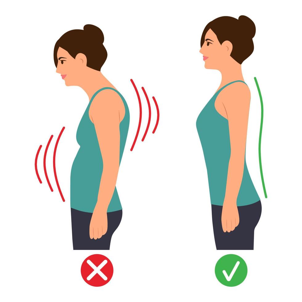 Postura de pie correcta e incorrecta. Curvatura espinal cervical. joroba. espalda saludable. ilustración vectorial sobre fondo blanco. vector