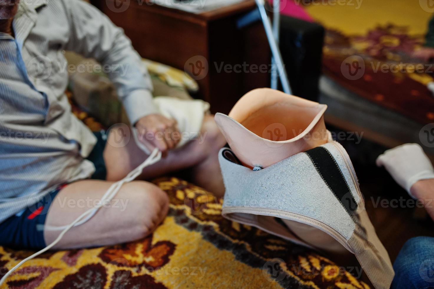 The prosthetist removes the measure from a person with a disability, man with amputee. photo
