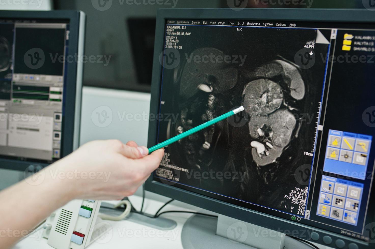 Medical theme. Diagnostic mri center in hospital, monitors of computer with human brain on it. photo