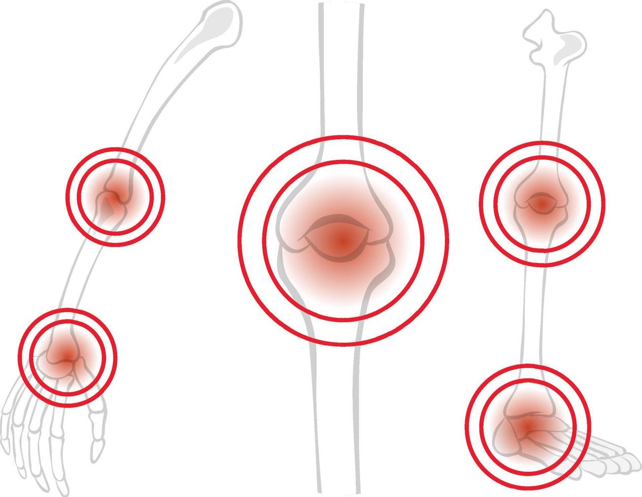 articulación de hueso humano con mancha roja vector