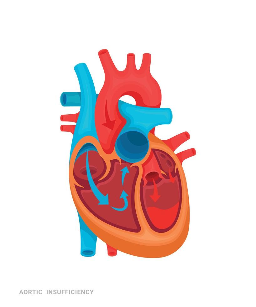 corazón de defecto vector