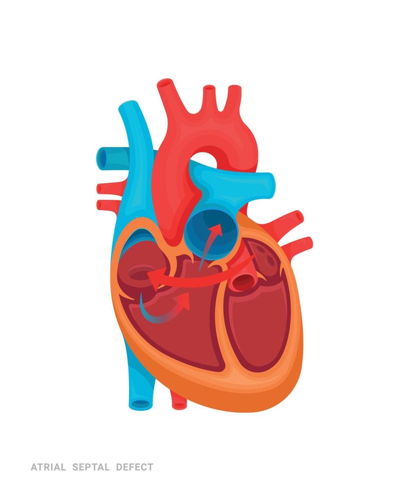 corazón de defecto vector