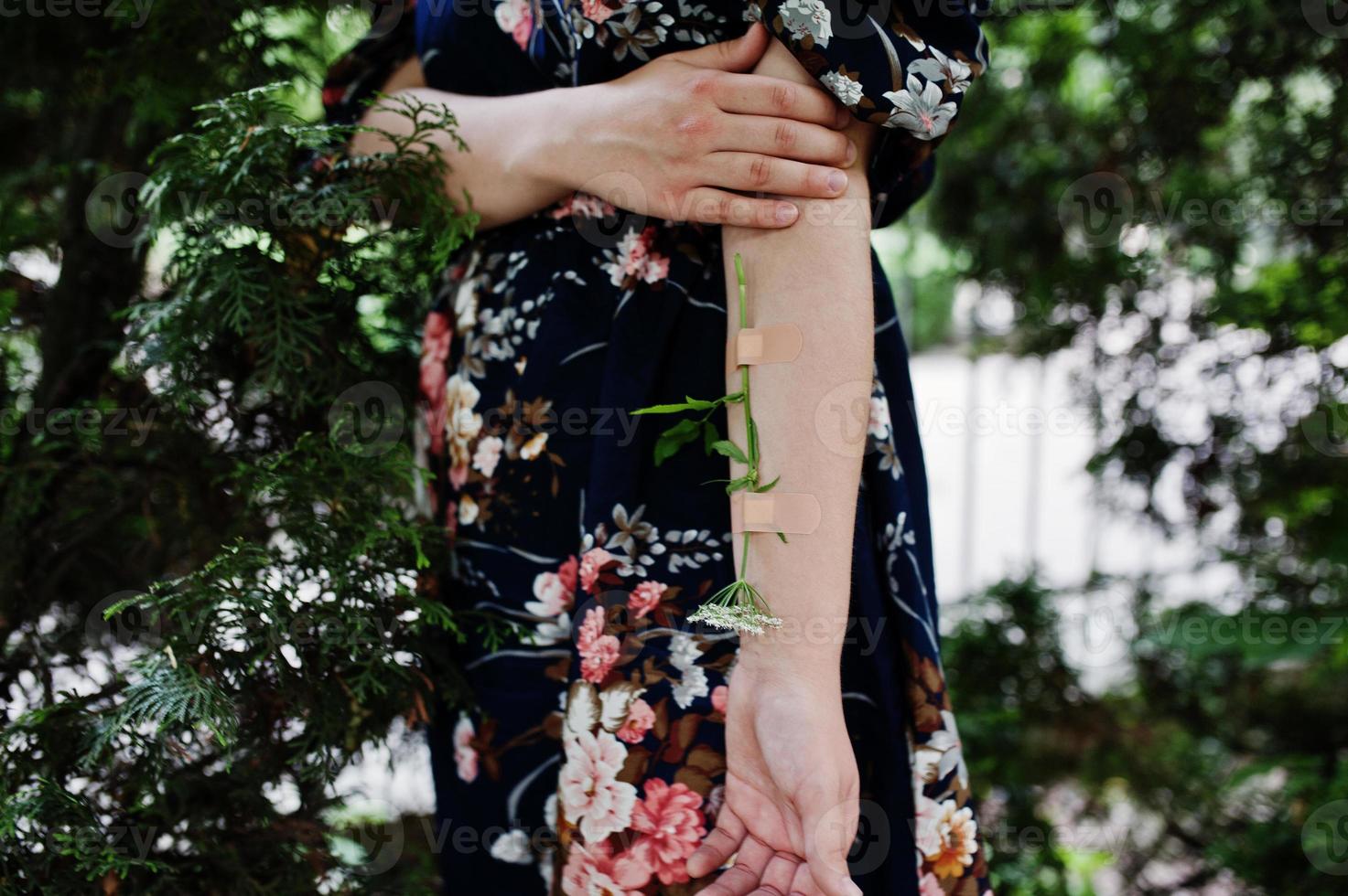 Close-up photo of a flower taped to a female arm.