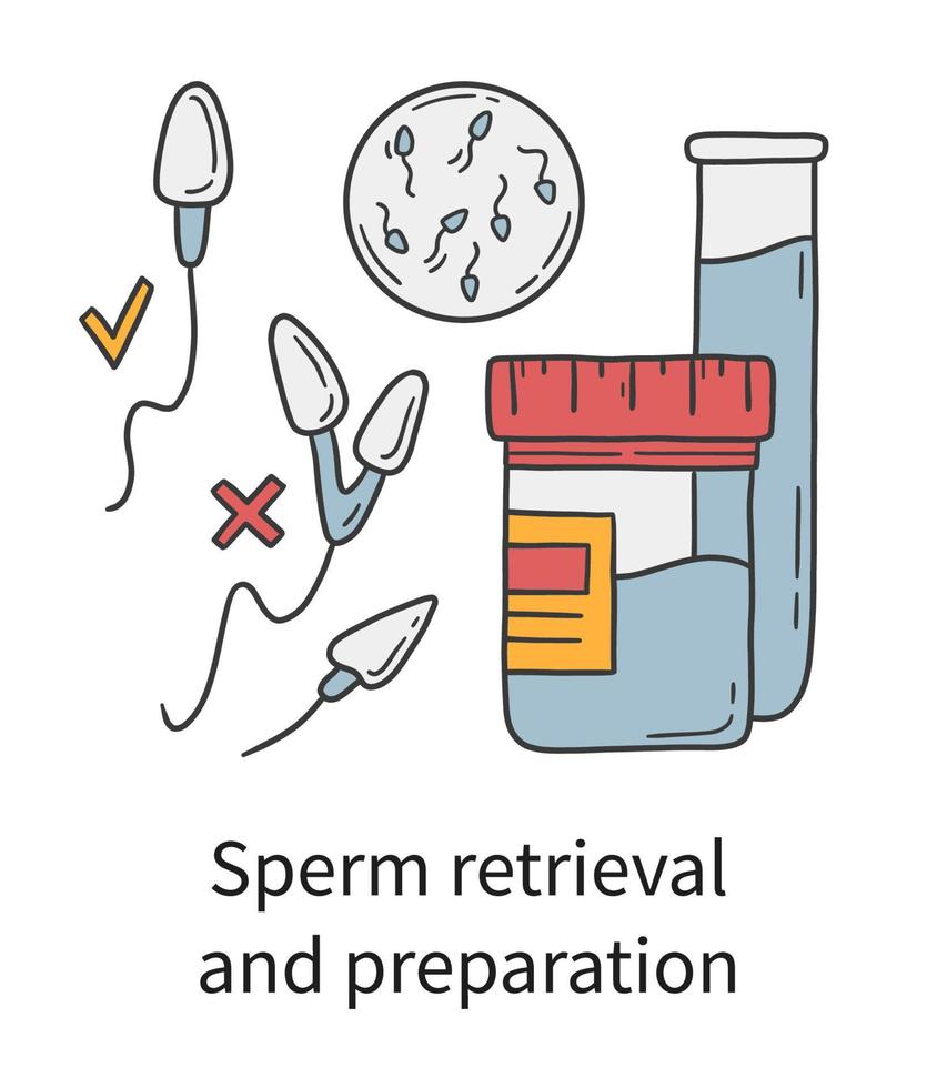 Sperm retrieval and preparation for In Vitro fertilization, vector