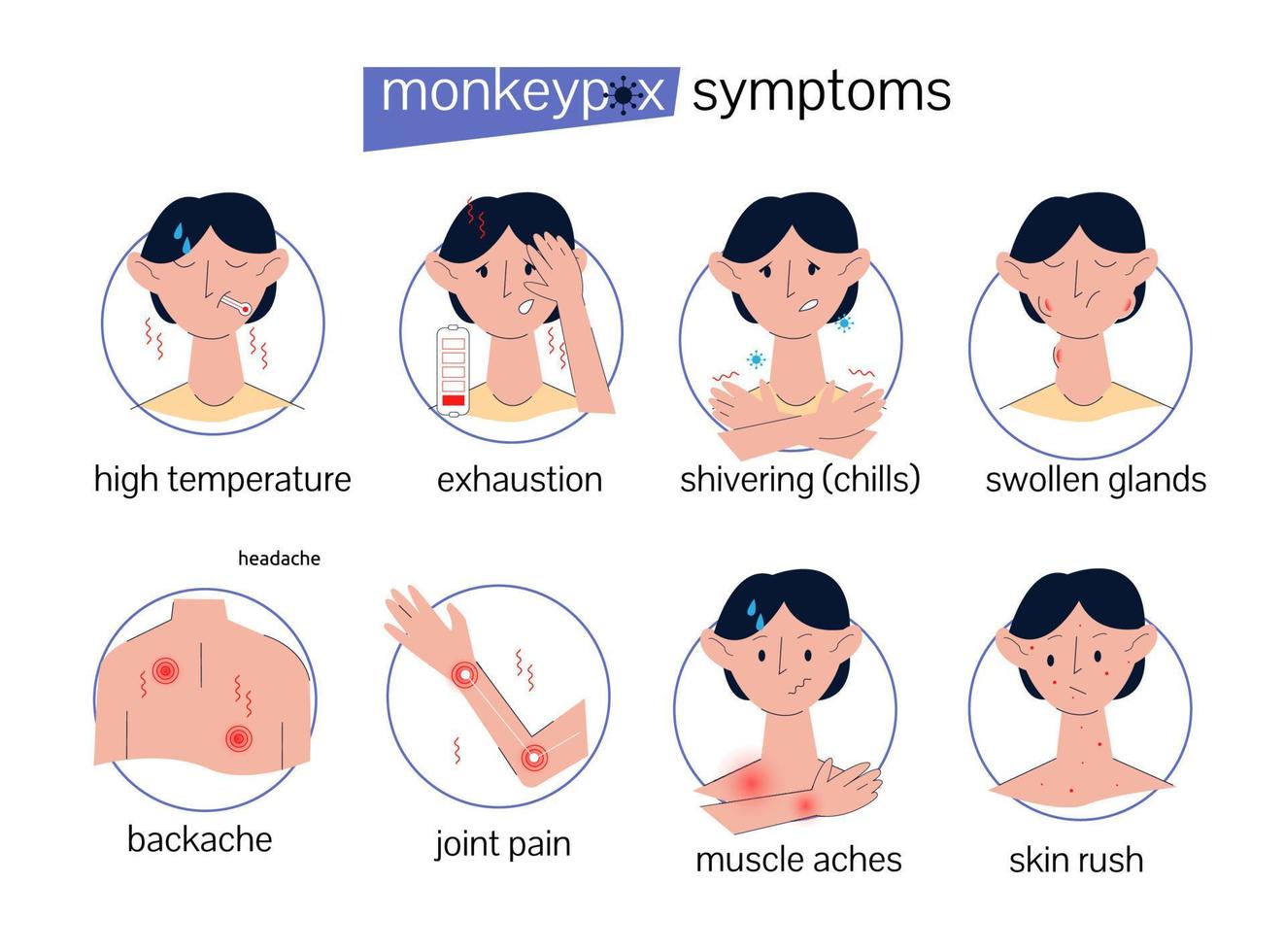 Symptoms of monkeypox. Information poster. Infographics with character and icons vector