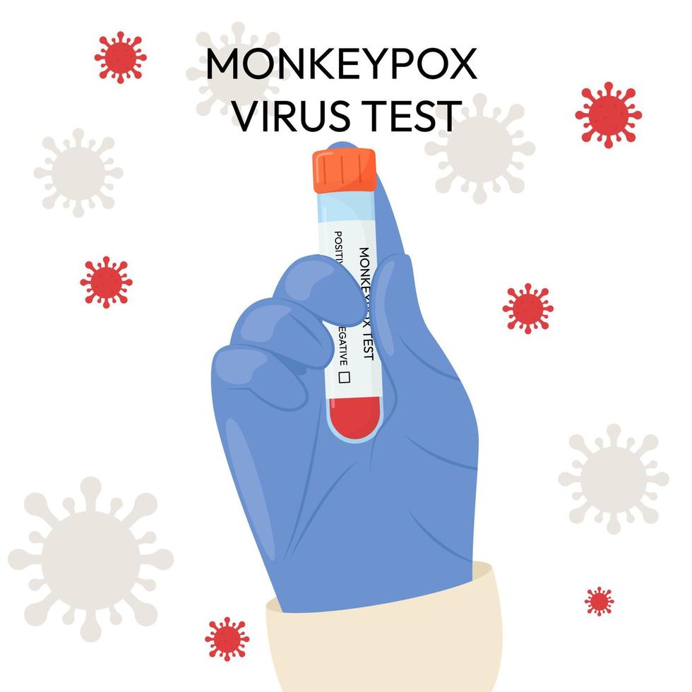 The hand of a doctor in a protective glove holds a test tube. Monkeypox virus test. Positive or negative test. Test systems. vector