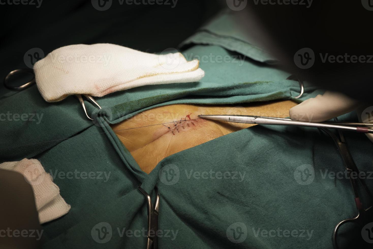 Doctor holding needle holder and suturing the wound photo