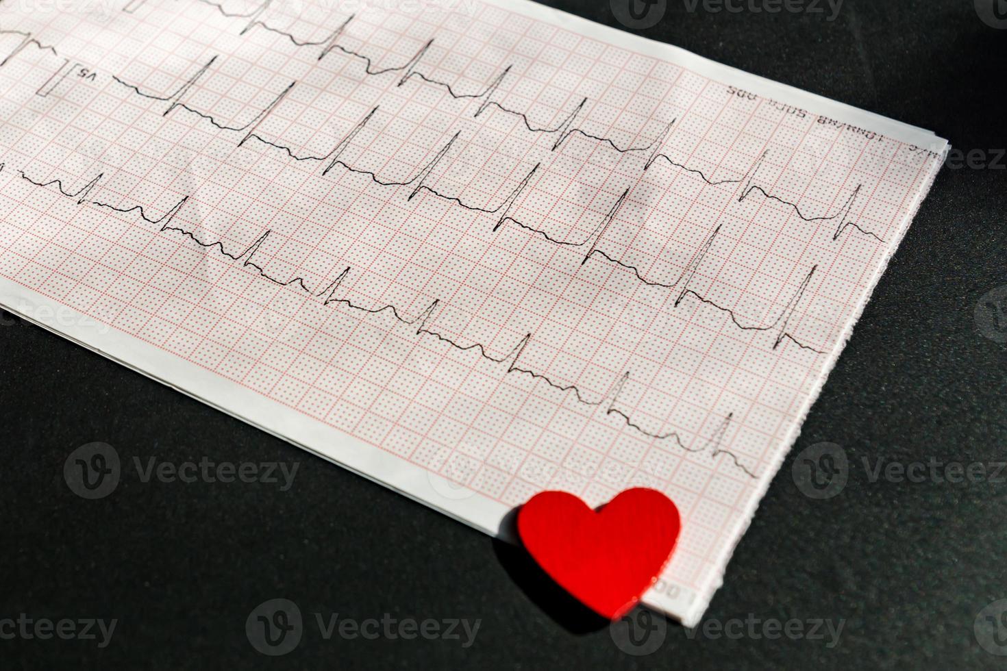 close up of an electrocardiogram in paper form vith red wooden heart. ECG or EKG paper on black  background.  medical and healthcare concept. photo