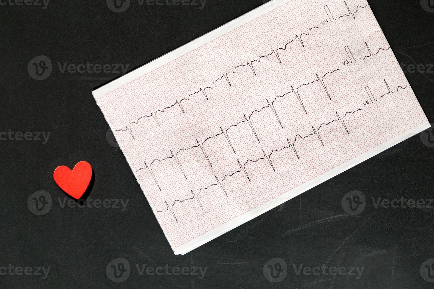 Top view of an electrocardiogram in paper form vith red wooden heart. ECG or EKG paper on black  background.  medical and healthcare concept. photo