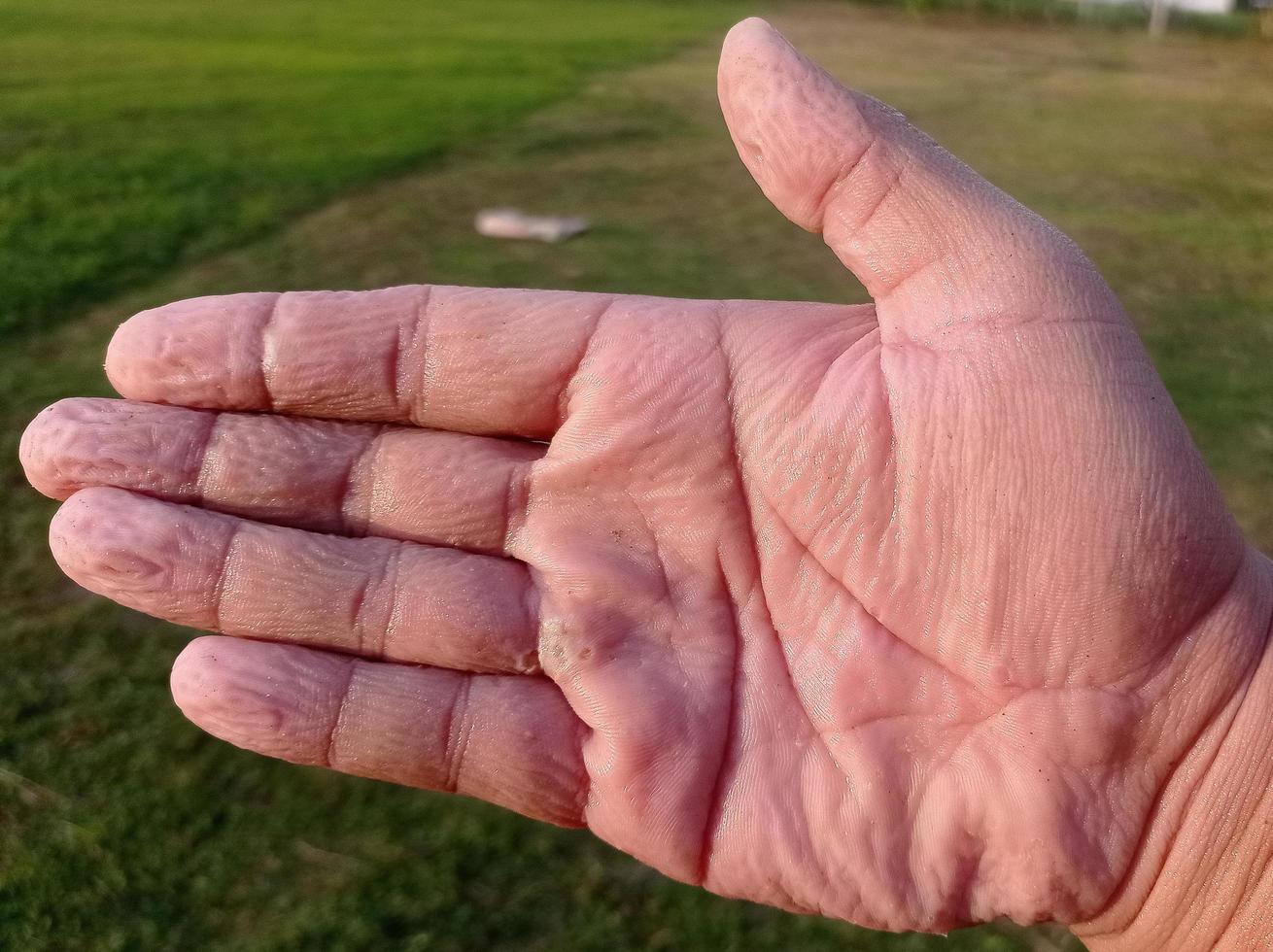 The skin of the palms is wrinkled and wet from water, submerged in water for too long. photo