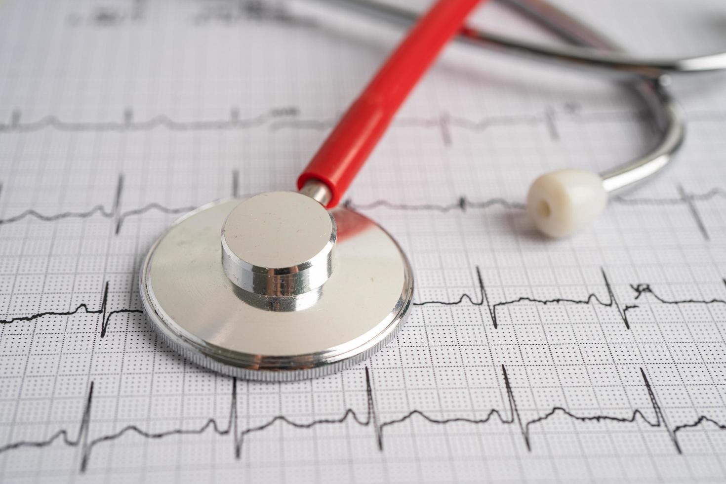 Stethoscope on electrocardiogram heart wave, heart attack, cardiogram report. photo