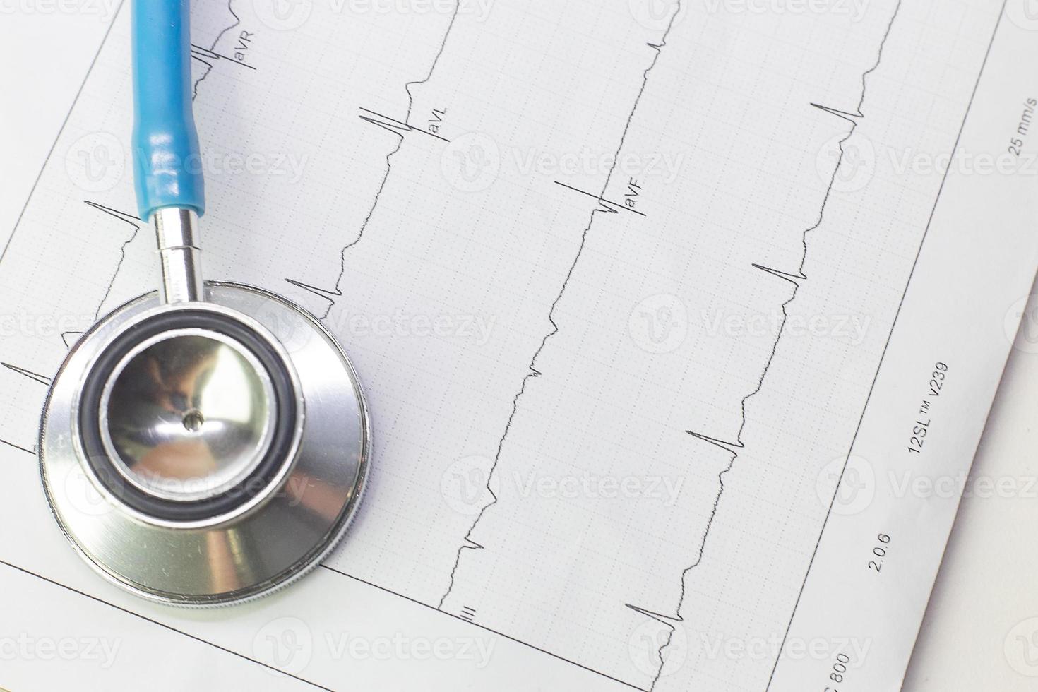 Blue stethoscopes and  Electrocardiography  chart close up image. photo