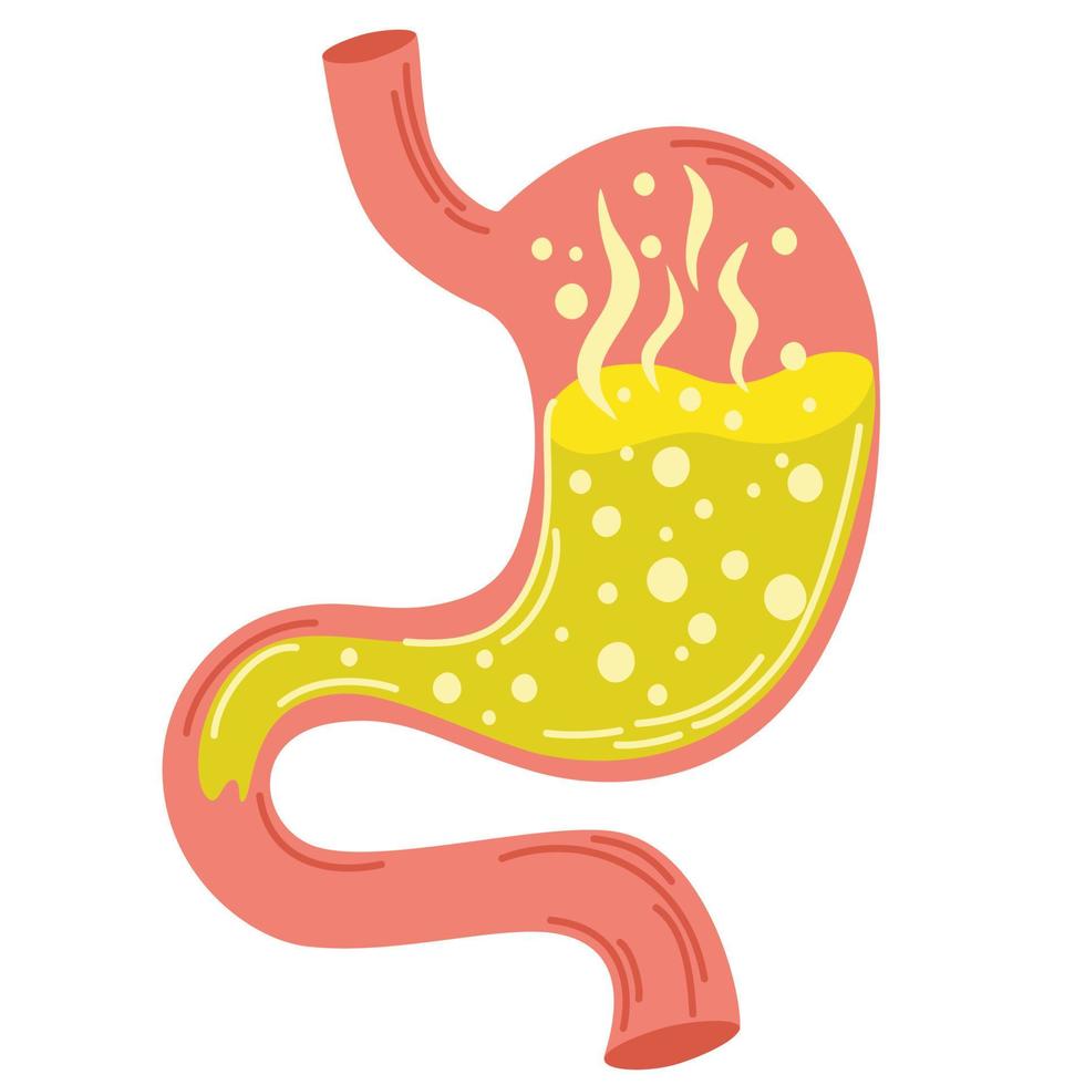 Human stomach. Gastritis and acid reflux, indigestion, vomiting, heartburn and stomach pain problems. Unhealthy stomach concept. Heartburn, illness, discomfort, pain. Flat vector illustration