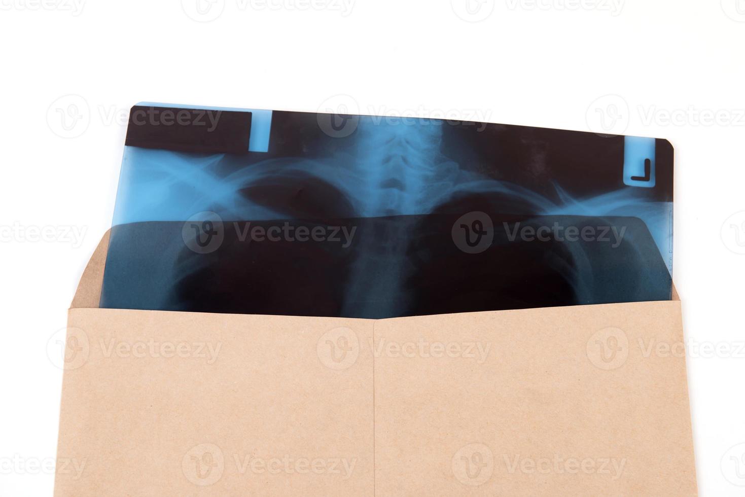 x-ray film of chest in brown envelope isolated photo