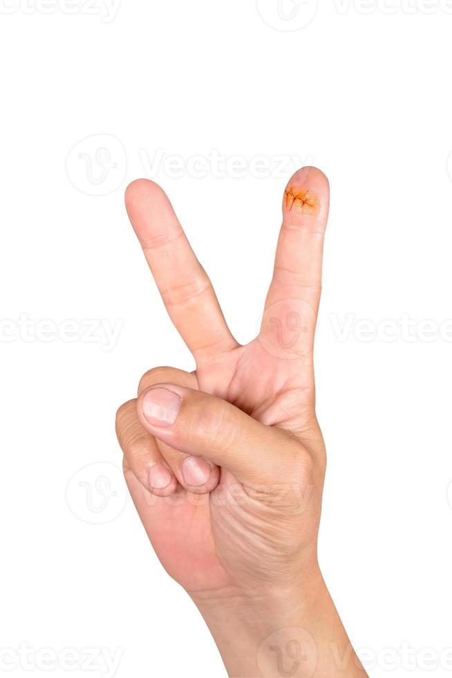 Hand showing the sign of victory with wound photo