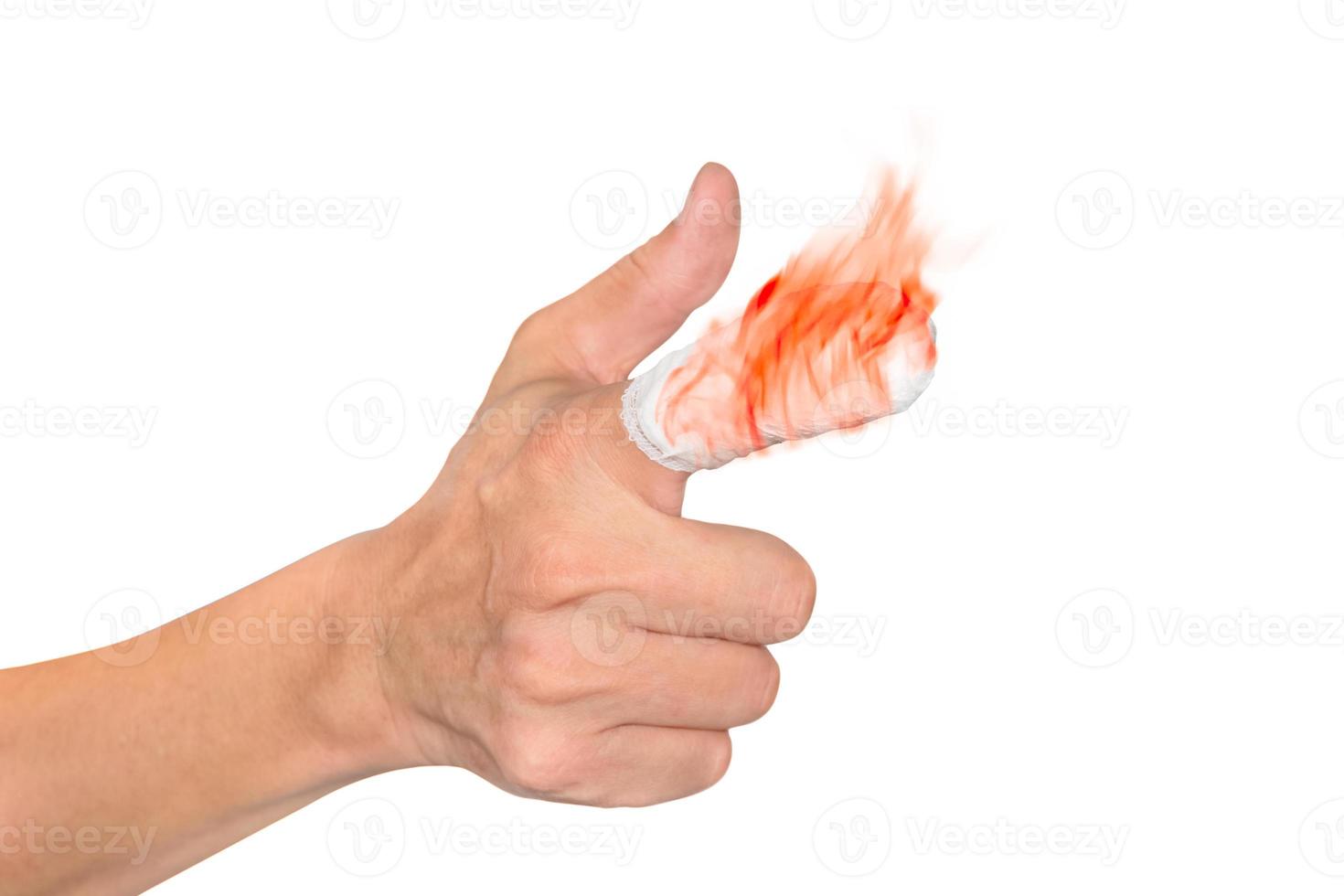 Forefinger with flame and bandage isolated on white background photo