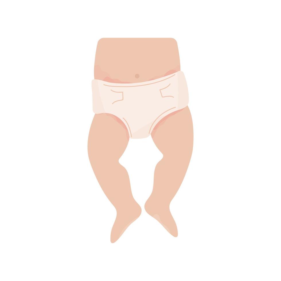 baby with diaper rash. Redness of the skin in the groin and abdomen. Allergy to sorbent, irritation. Dermatological problems. Isolated image on a white background. Vector illustration, flat