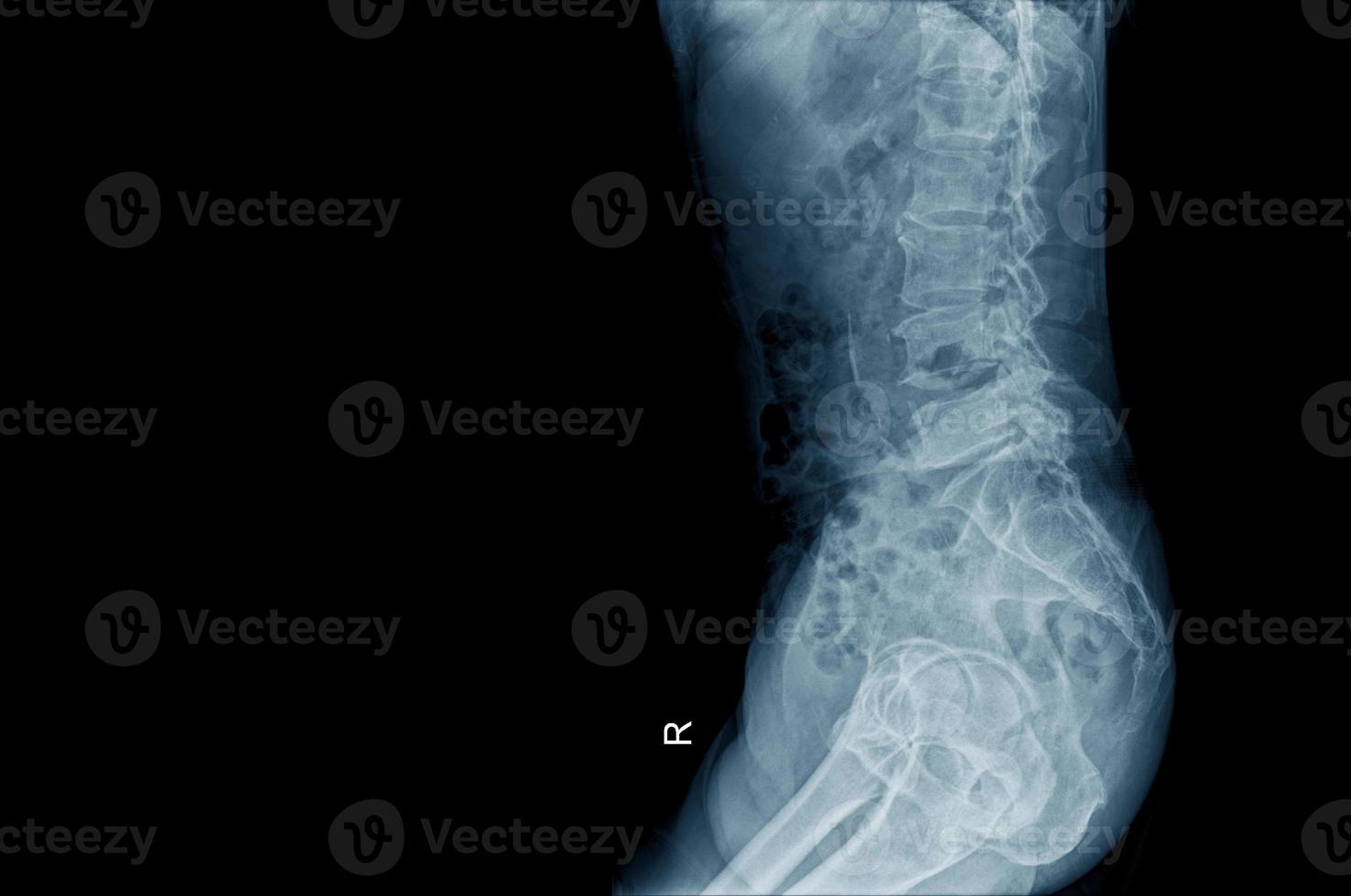 lateral view of human structure 10764681 Stock Photo at Vecteezy Biology Diagrams