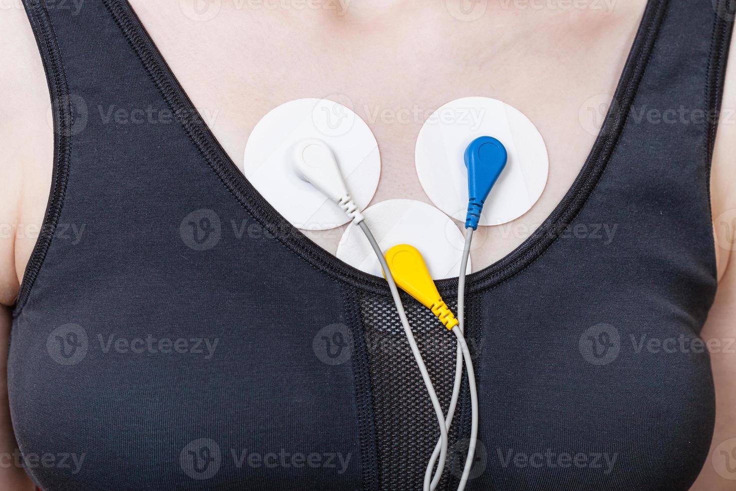 electrodes of Holter monitor are attached to chest 10782017 Stock Photo