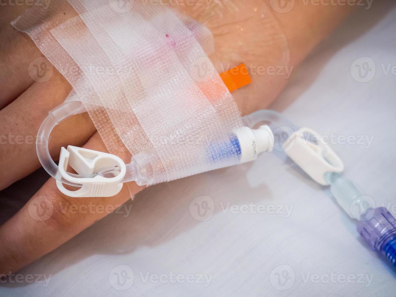 Asian woman patient hand on IV drip with saline solution, fluid replacement therapy photo