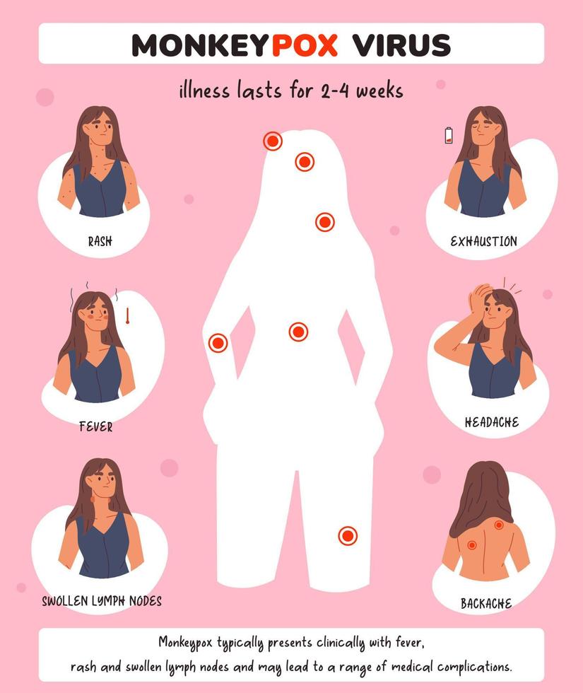 Medical leaflet Monkeypox virus symptoms . Information poster with symptoms of monkeypox virus. Template of virus symptoms. Fever, headache, rash. Healthcare and Medical vector