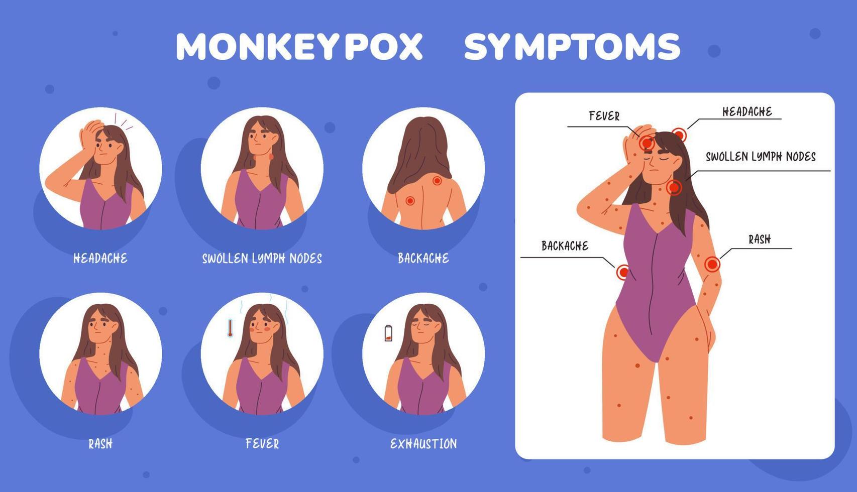 Monkeypox virus symptoms medical booklet. Template of virus symptoms. Fever, headache, rash. Information poster with symptoms of monkeypox virus. Healthcare and Medical vector