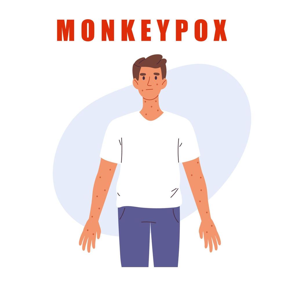 Monkeypox virus. Man with rash. Skin infections. Monkeypox virus infographic. Isolated vector illustration