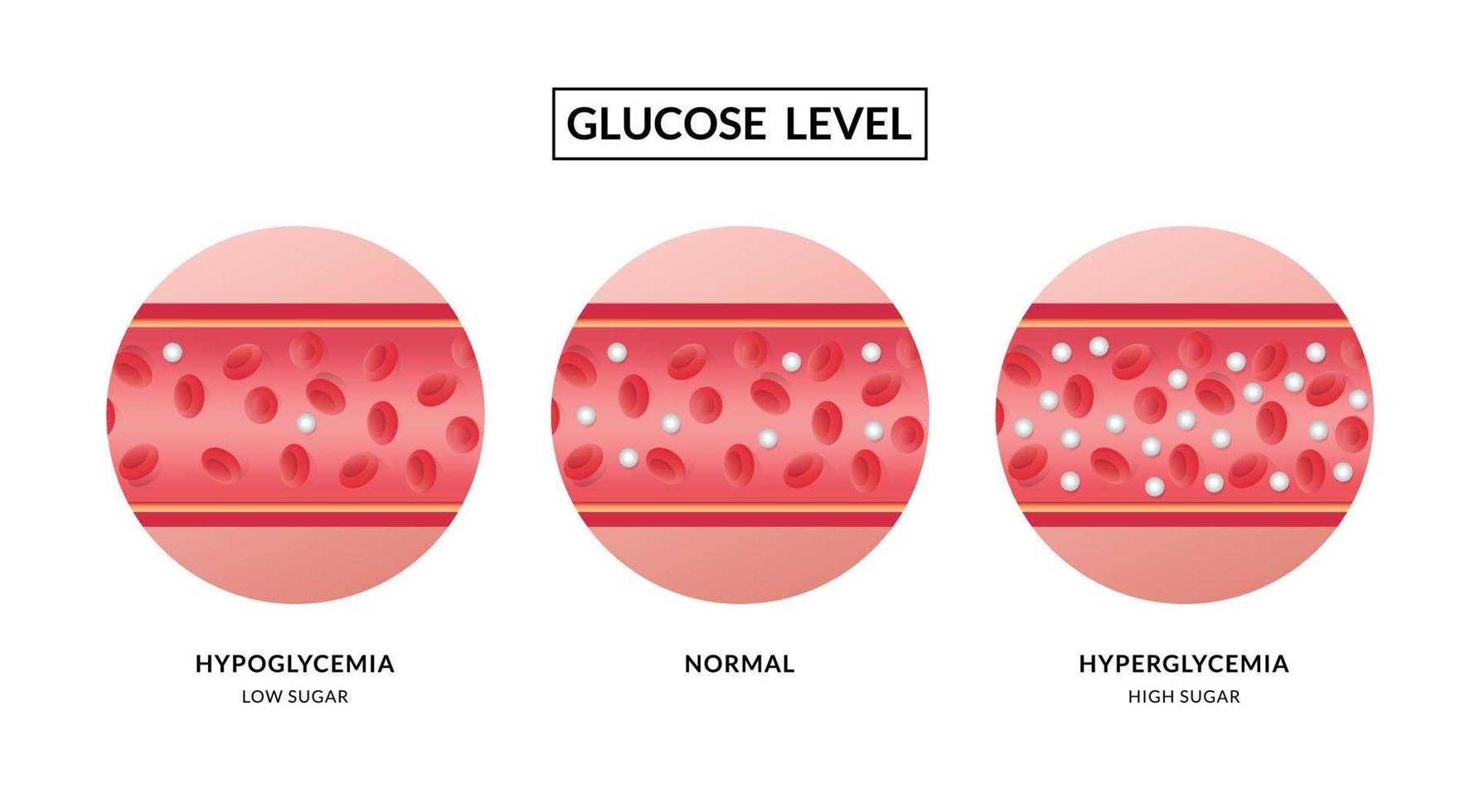 Glucose in the blood vessel. Hypoglycemia and Hyperglycemia vector