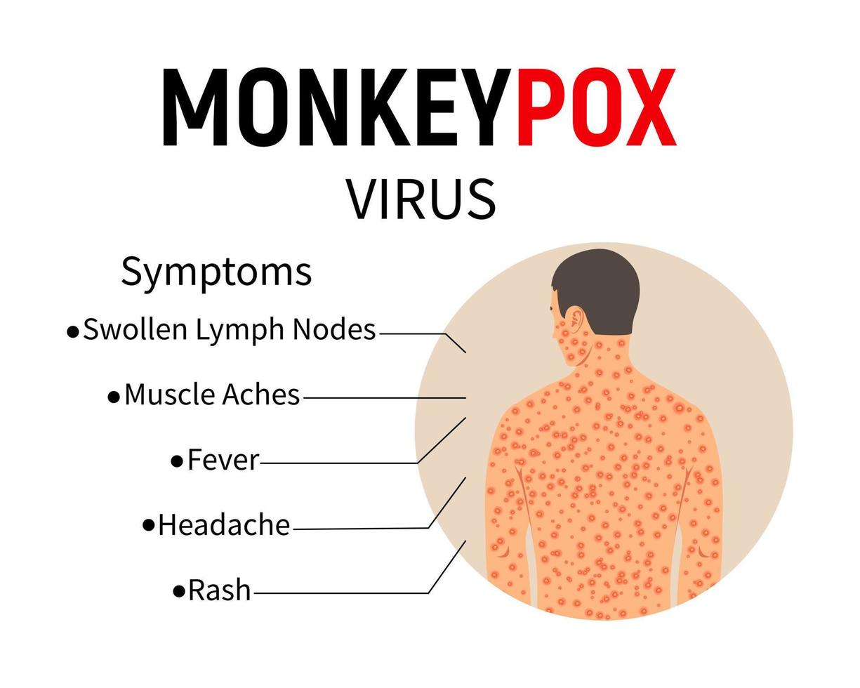 Symptoms of monkeypox. Disease infographic. Text and man with rash and ulcers on the body. Symptoms of the disease - swollen lymph nodes, muscle pain, fever, headache, rash. Vector. vector