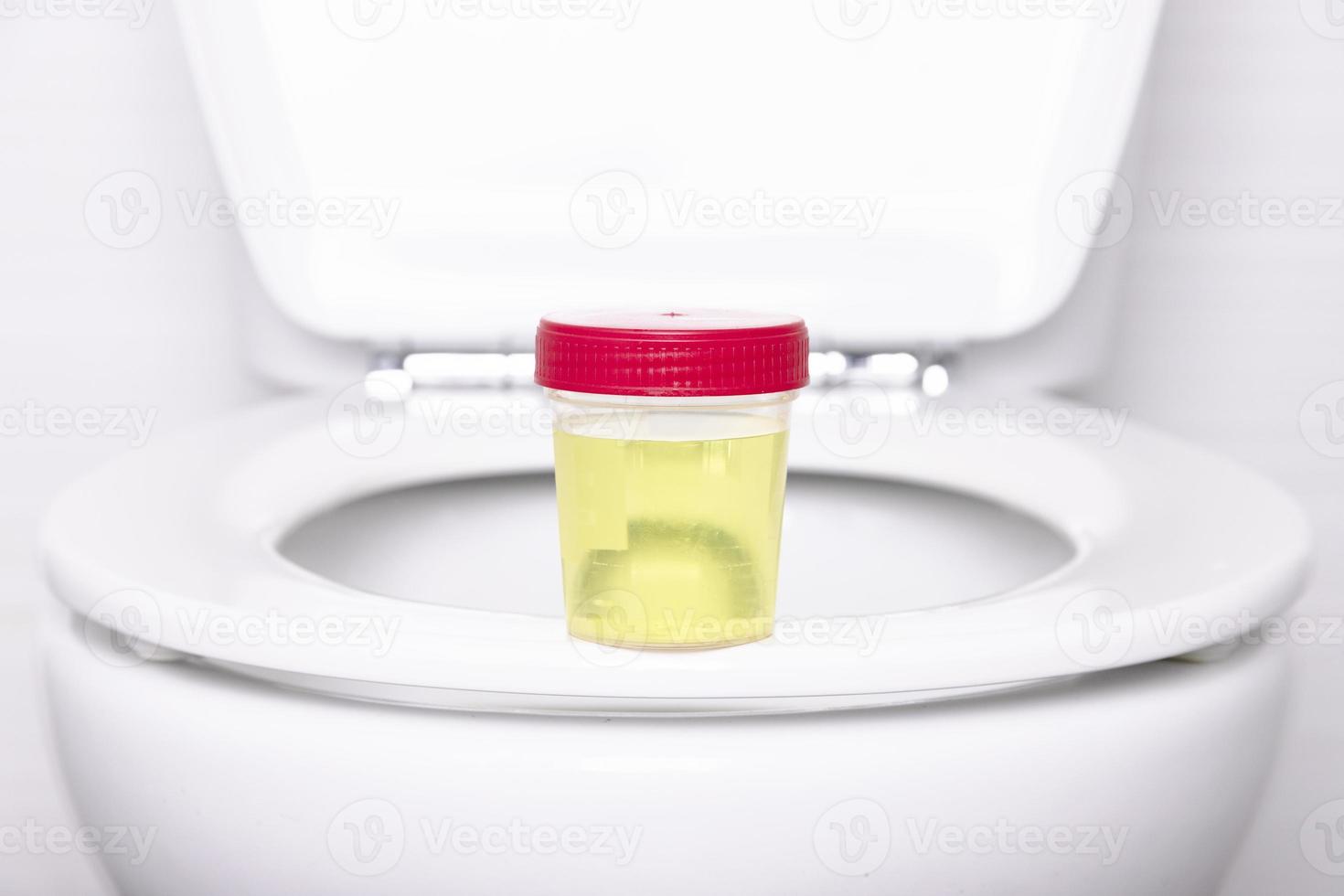 A urine sample in a medical container sits on the rim of a white household toilet. Selective focus. photo