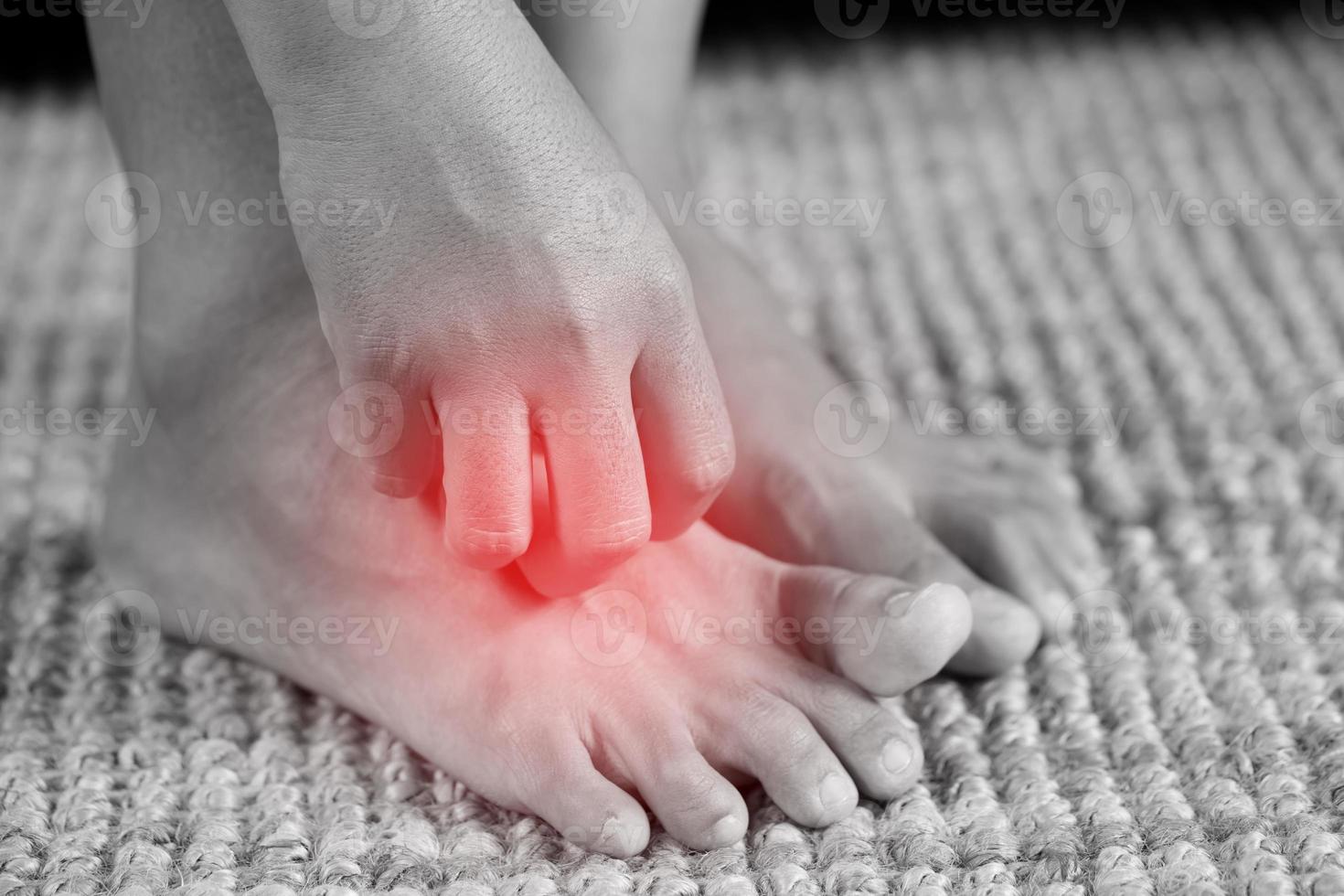 Fungal foot itching caused by biting feet 11027618 Stock Photo at Vecteezy