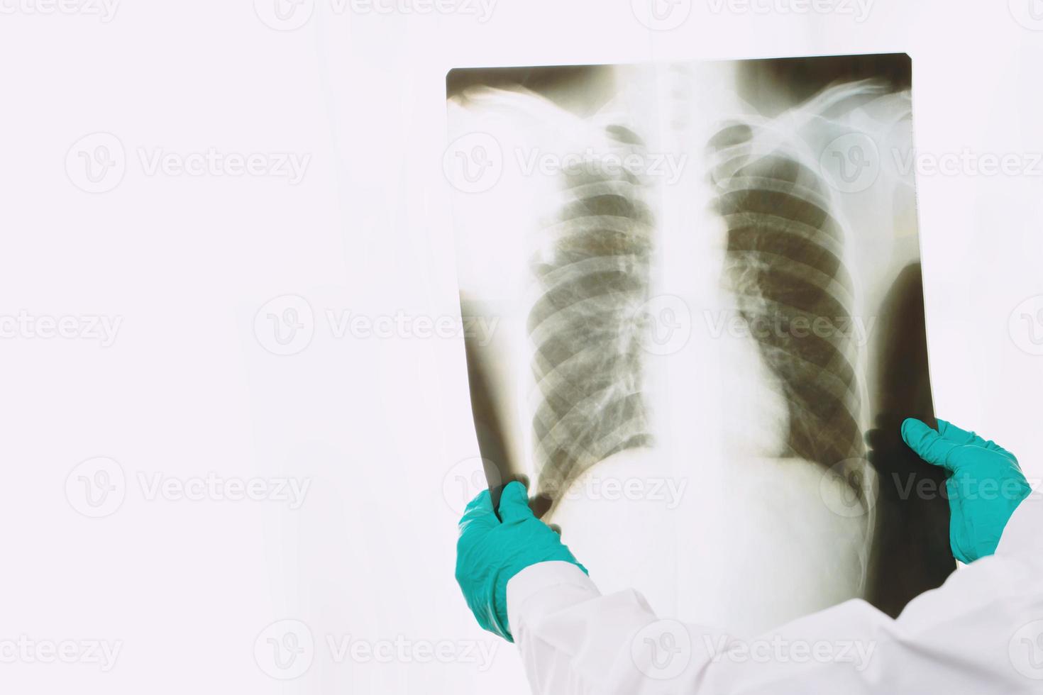 el médico está examinando una película de rayos X de los pulmones foto