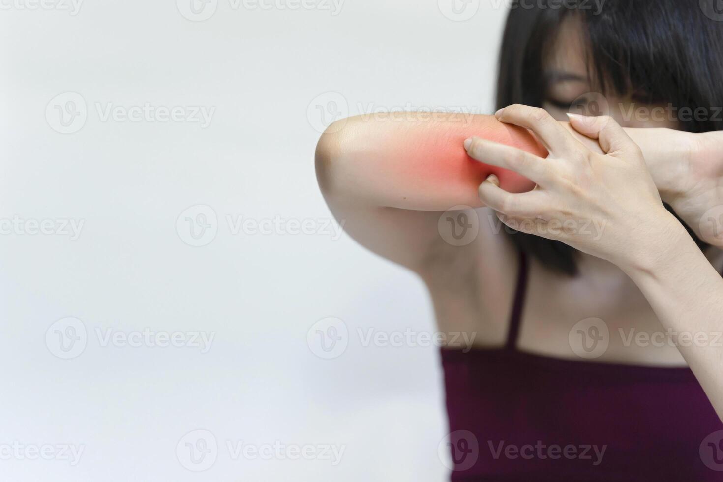 Red marks on a woman's arm that itches from an allergy or insect bite