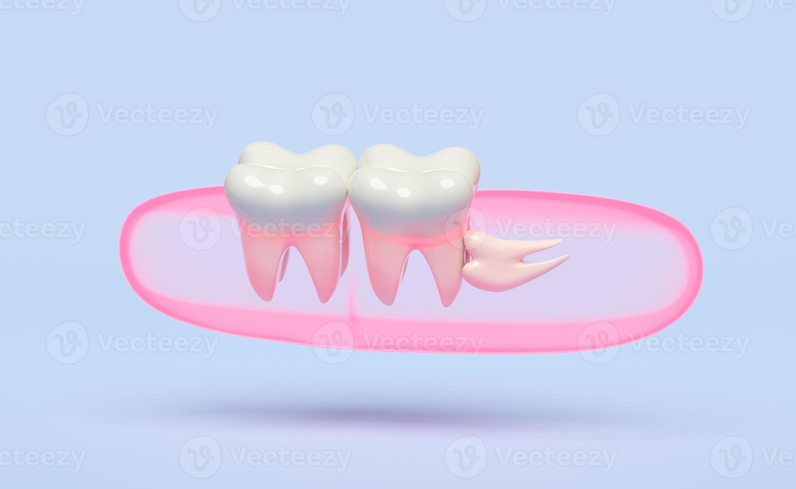 dental examination of the dentist, 3d wisdom teeth model problems icon with gums isolated on blue background. health of white teeth, oral care, 3d render illustration photo