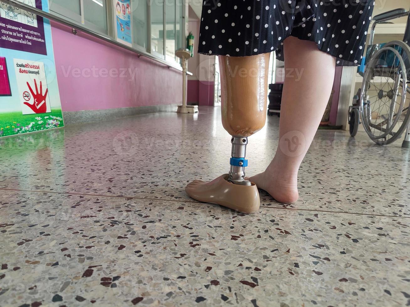 Disabled young women try to walk with prosthetics photo