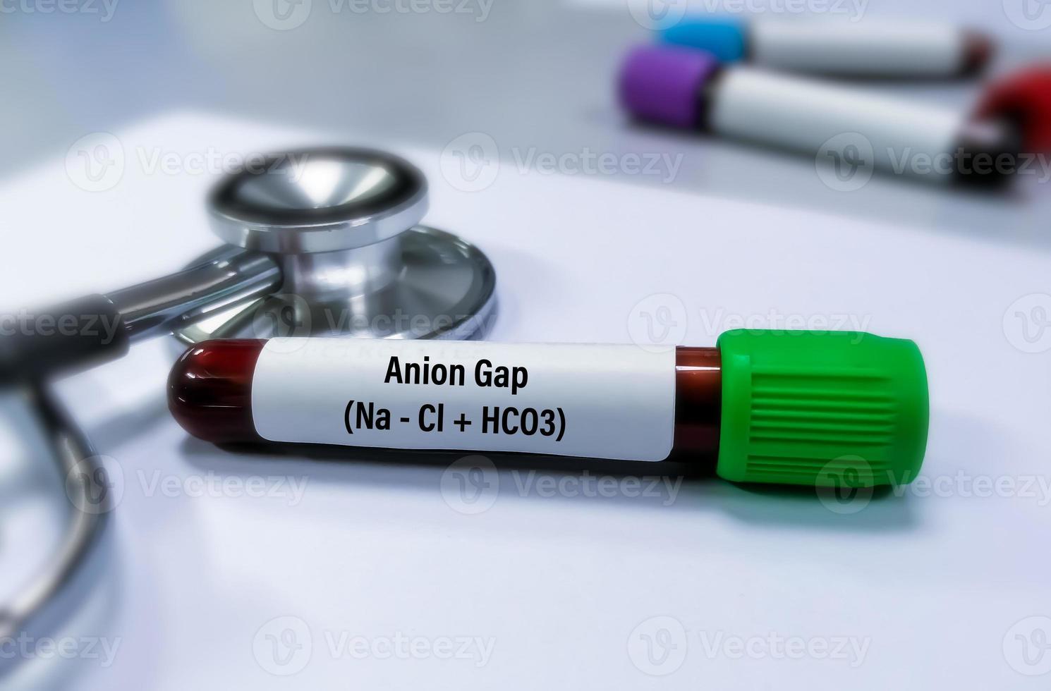 Blood sample isolated for Anion Gap test to diagnose electrolytes