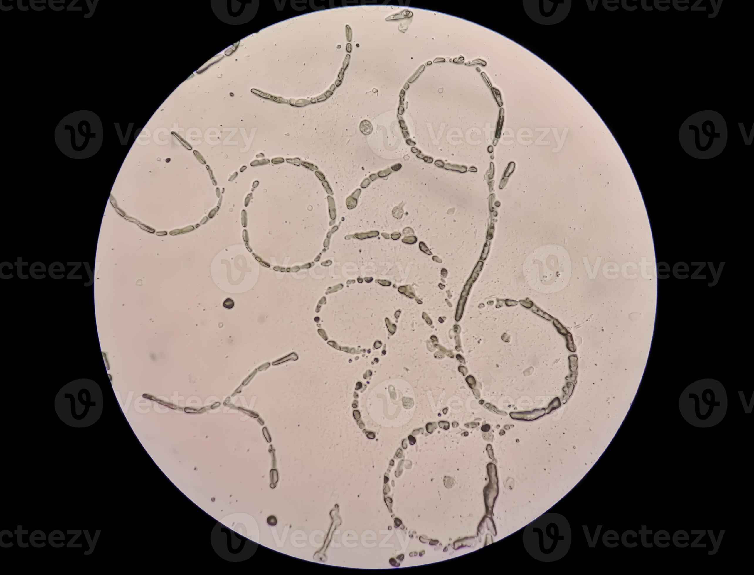 Microscopic image showing Hyphae of dermatophytes,, skin scraping for