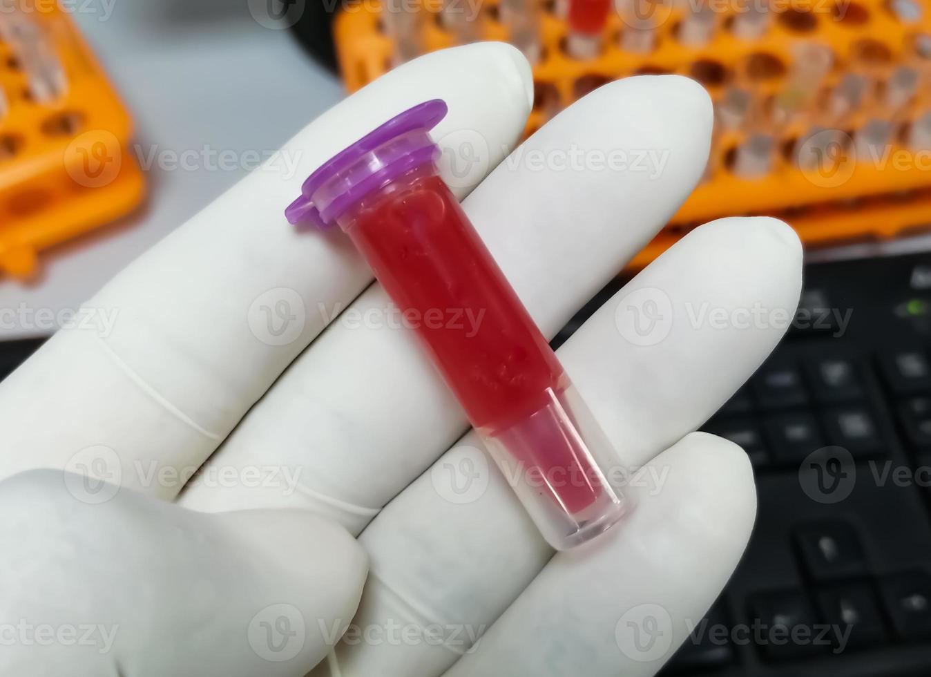 Scientist holding eppendorf with hemolyzed blood sample. Hemolysis sample can cause of false patient report. pre-analytical error. photo