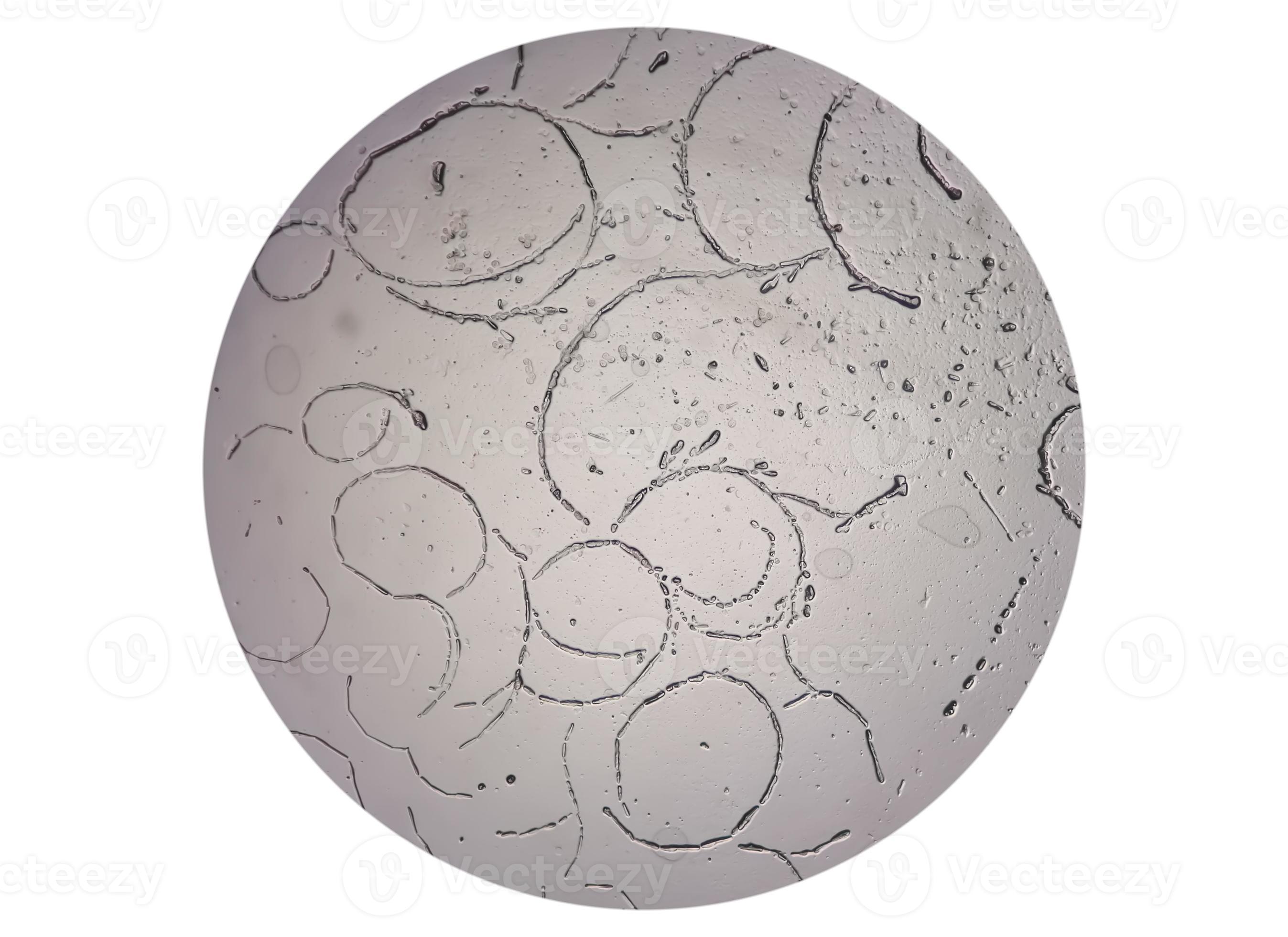 Microscopic image showing Hyphae of dermatophytes,, skin scraping for