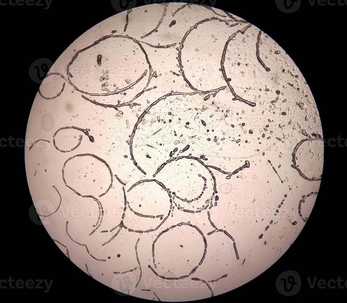 Microscopic image showing Hyphae of dermatophytes,, skin scraping for fungus test photo