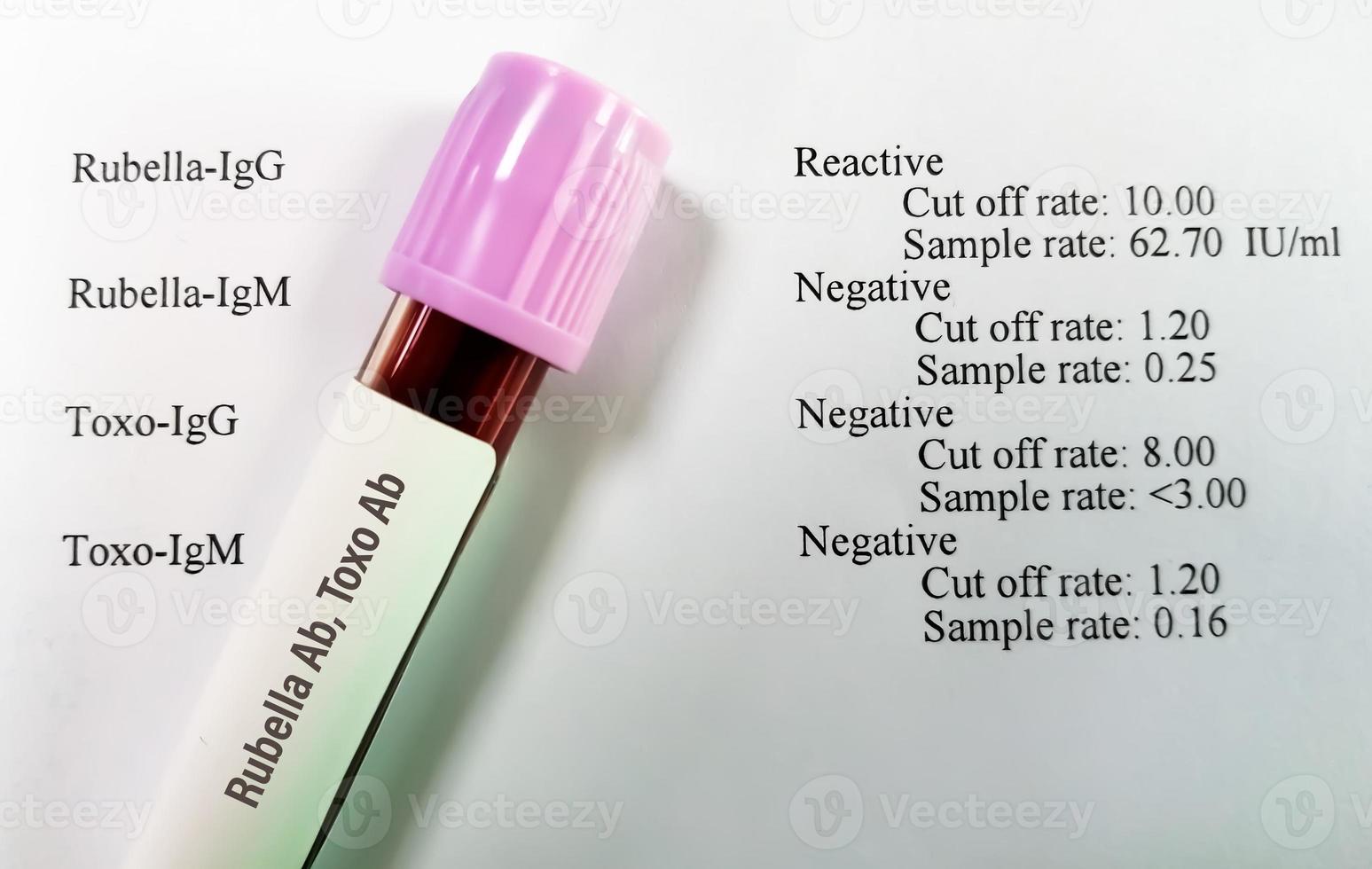 Blood sample isolated on patient report. Rubella and Toxoplasma antibodies testing. photo