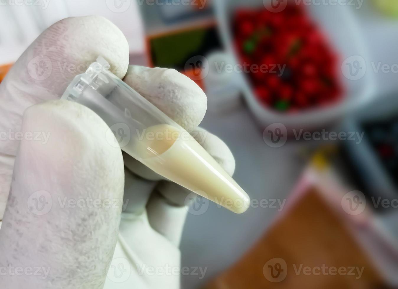 Scientist or Biochemist hold test tube with Lipemic blood sample. High Triglyceride contain blood sample. Lipid profile. photo