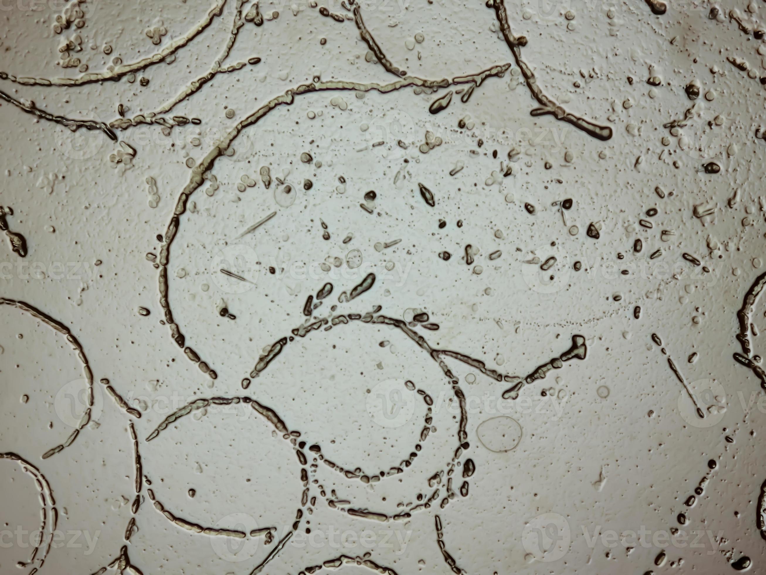 Microscopic image showing Hyphae of dermatophytes,, skin scraping for
