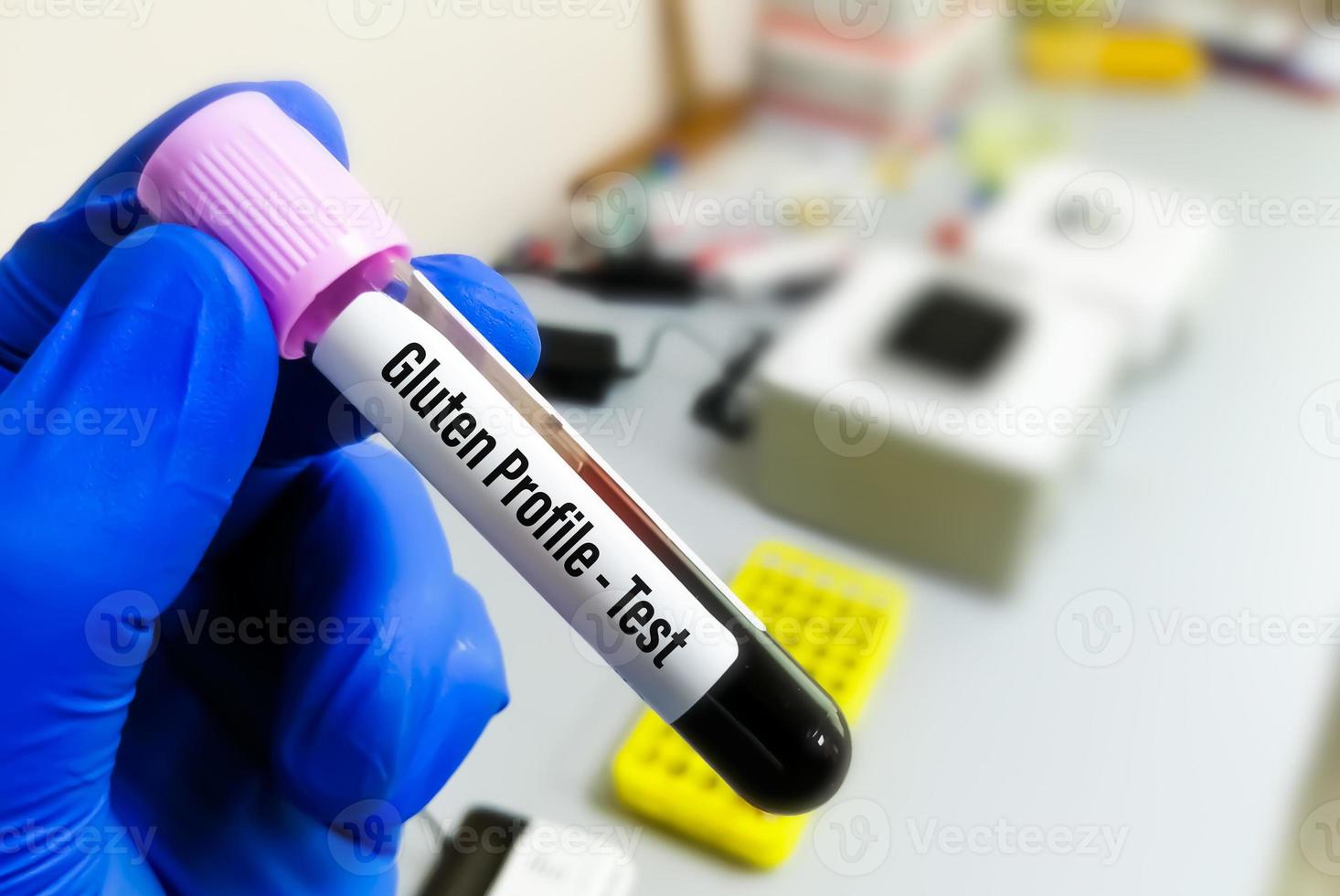 Blood sample for Gluten test or Gluten profile test in laboratory. Diagnosis for coeliac disease. photo